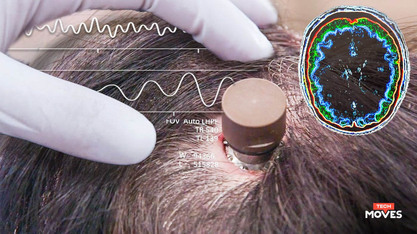 Elon Musk’s Neuralink Prepares to Implant Second Human Patient